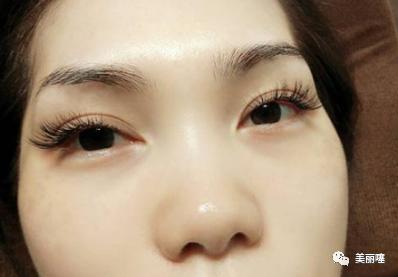 种睫毛存在哪些安全隐患,大眼睛要不要种睫毛