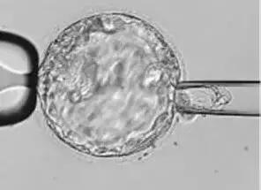 取了两个卵子胚胎成功概率大吗,取出的卵子质量差胚胎成功率高吗