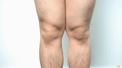 冬天觉得膝盖特别冷解决方法,膝盖冷一招搞定