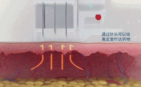 夏季告别油腻肌肤,夏日肌肤清爽指南