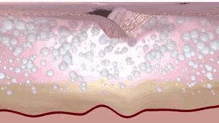 眼霜到底有没有用啊,眼霜里面有什么成分不能用