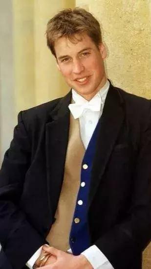 激光近视手术做之前需要什么准备,激光近视手术切的是什么