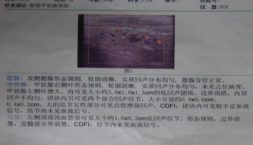 45岁女人声音嘶哑有什么病吗,46岁女突然嗓子哑了有痰吐出困难