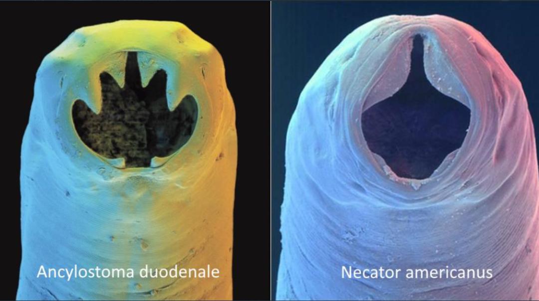 他们生吞3500寄生虫卵,花费1.5万元,只为治疗秃头