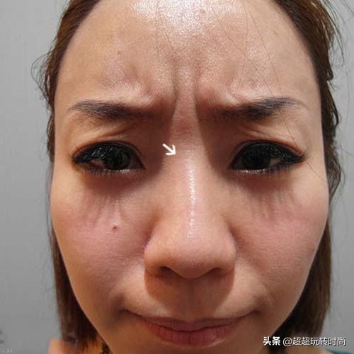 女人人中最近出现了皱纹,女人脸上有明显的皱纹是多少岁了