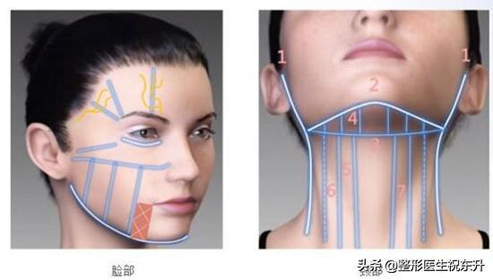 你的皱纹是怎样的,你的颈纹是这样的吗