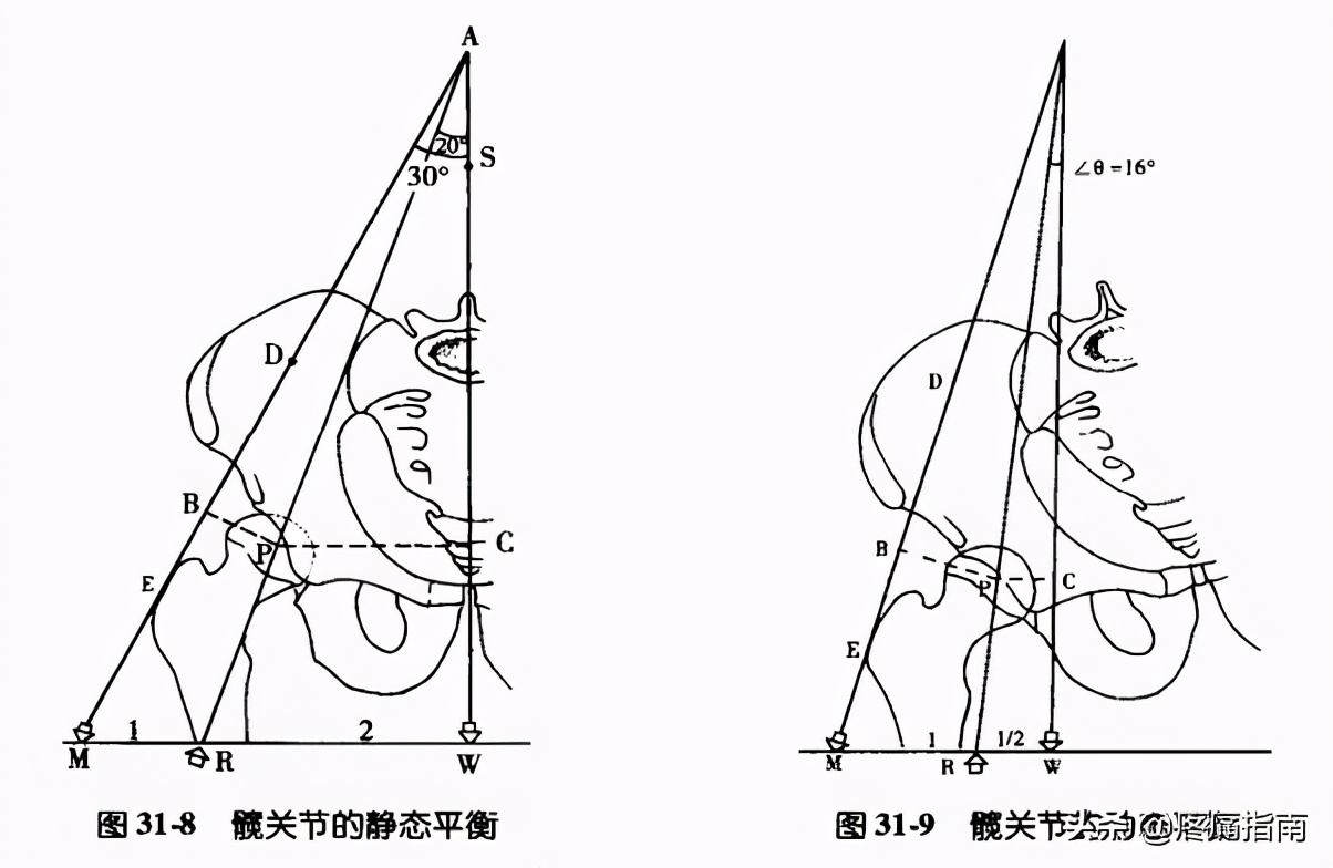 夏天无注射液能治疗骨头坏死吗,骨头坏死用针刀镜有用么