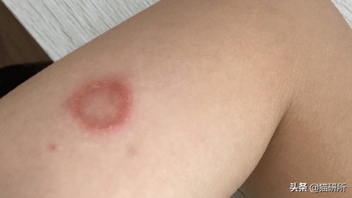 铲屎官得了猫癣怎么处理,铲屎官必知猫咪急救办法