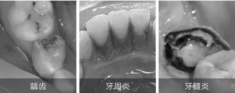 0-2岁儿童牙膏排名第一名牙医推荐,青少年牙膏排名第一名牙医推荐