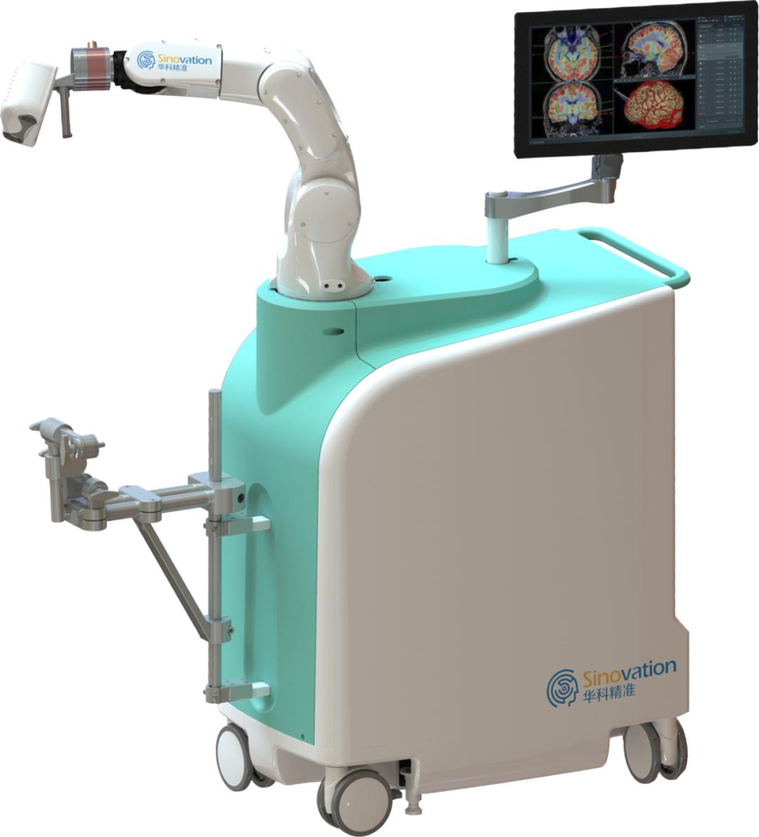 脑瘤不开颅手术成功案例,激光消融脑瘤手术