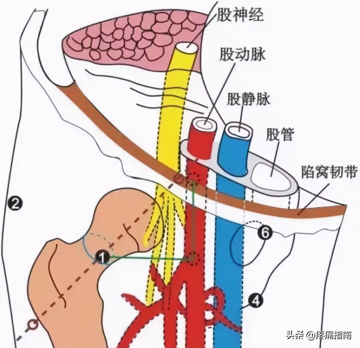 夏天无注射液能治疗骨头坏死吗,骨头坏死用针刀镜有用么