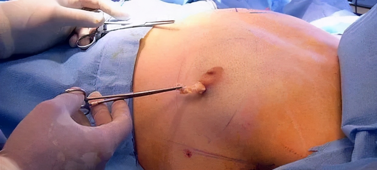 男性乳房发育在家如何治疗,男性乳房发育导致腋下不舒服