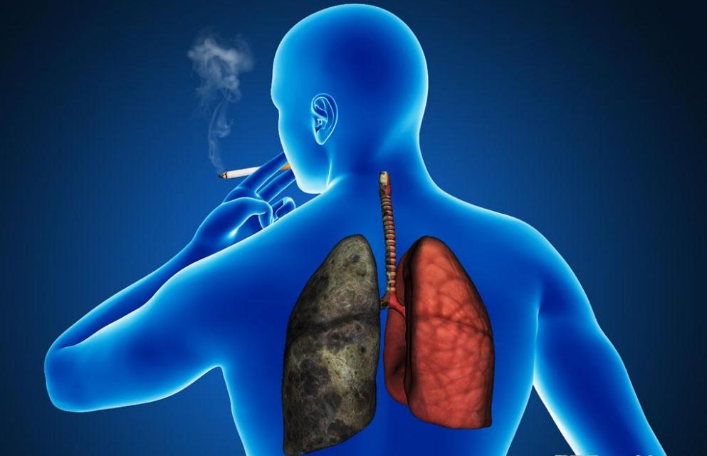 30年时间，肺癌发病率增长465%！幕后最强“推手”就是它了