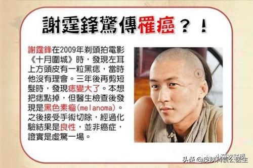 边缘不整齐的痣都是黑色素瘤吗,痣突然变大不规则一定是黑色素瘤