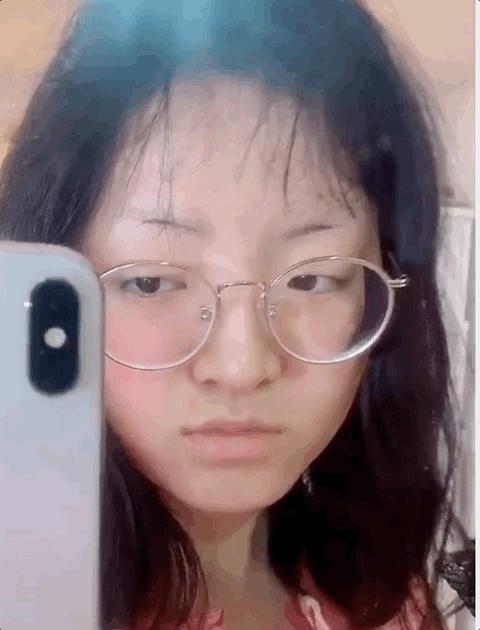 整容毁掉容貌的女子,一名女子整容却毁了她一生