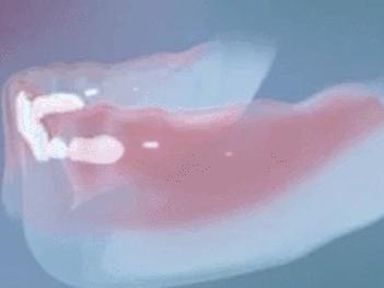 小孩乳牙没有掉要去医院拔牙,恒牙出来多久了乳牙未掉需要拔牙