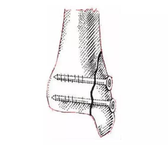 猫咪狗狗骨折了怎么办？扒一扒宠物“骨子里”的那些事