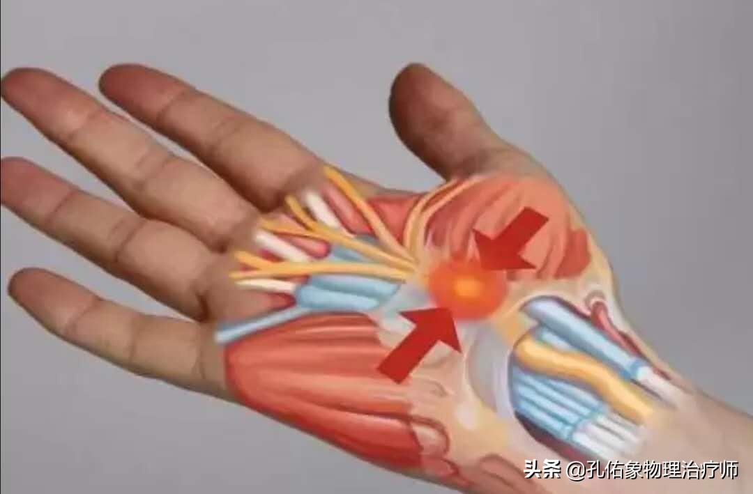 手部麻木长时间不缓解是什么原因,手部麻木无力怎么办