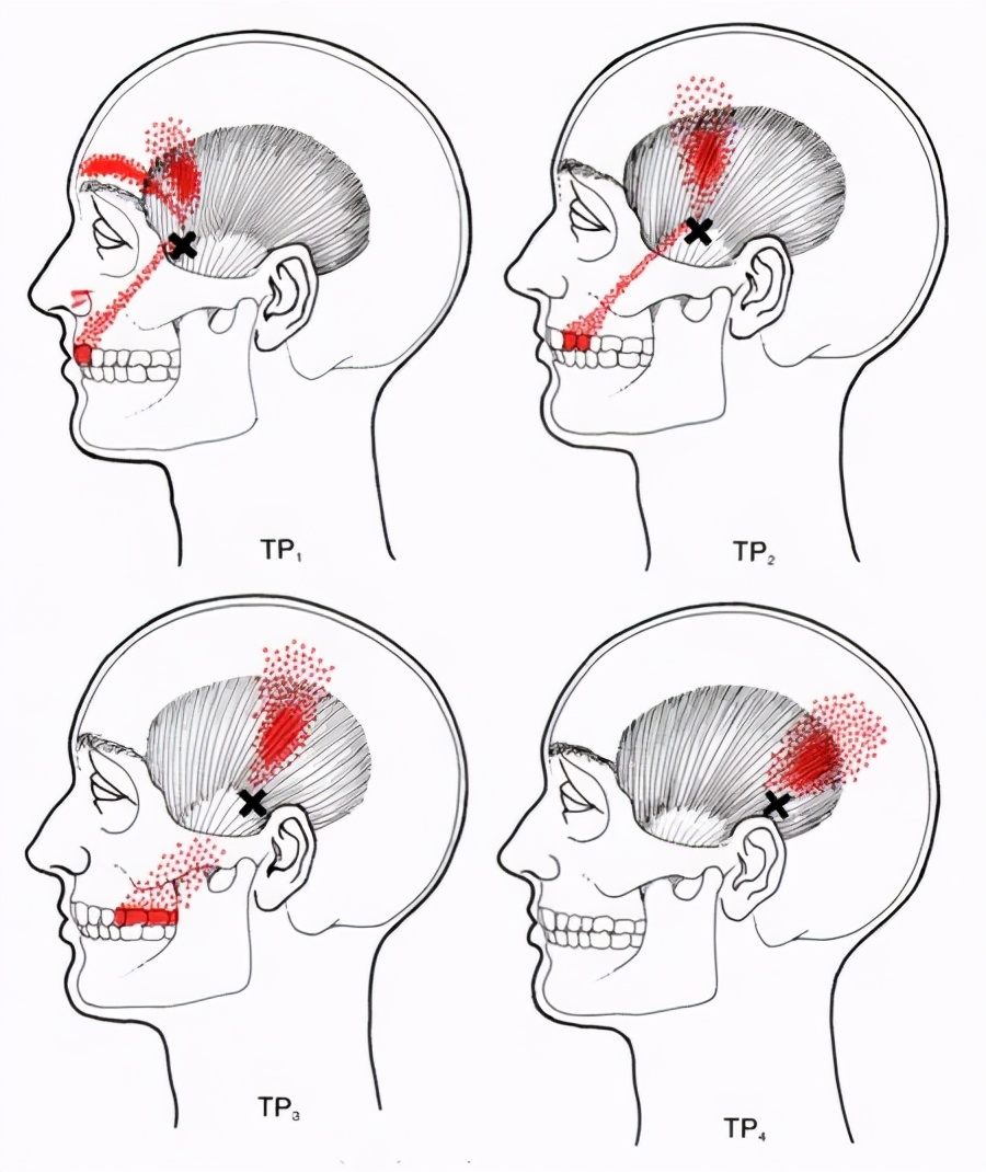 康复训练手法干货分享,康复治疗师肌肉