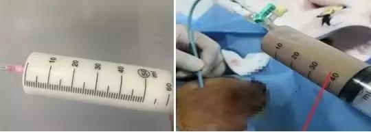 苏州各大医院的普外科,苏州科技城医院特色科室