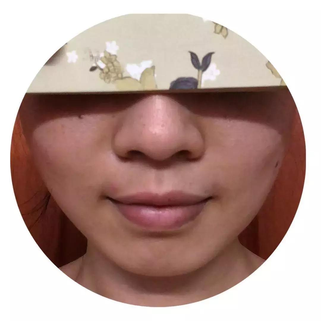 皮肤改造计划丨去痘印、美白、淡化眼部细纹，解决问题并不贵~