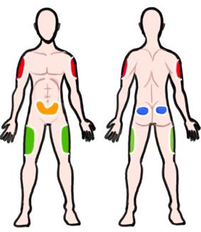 胰岛素降糖不理想,胰岛素一个部位注射不吸收怎么办