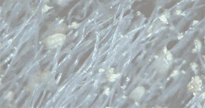 螨虫清除测评,螨虫测评