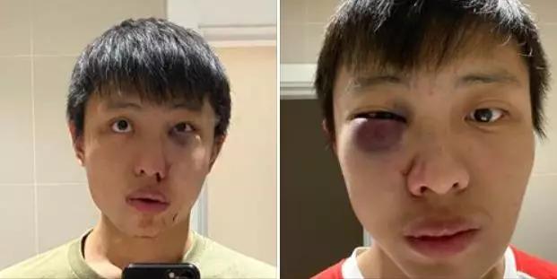 疫情华人在海外现状,疫情海外华人怎么样了