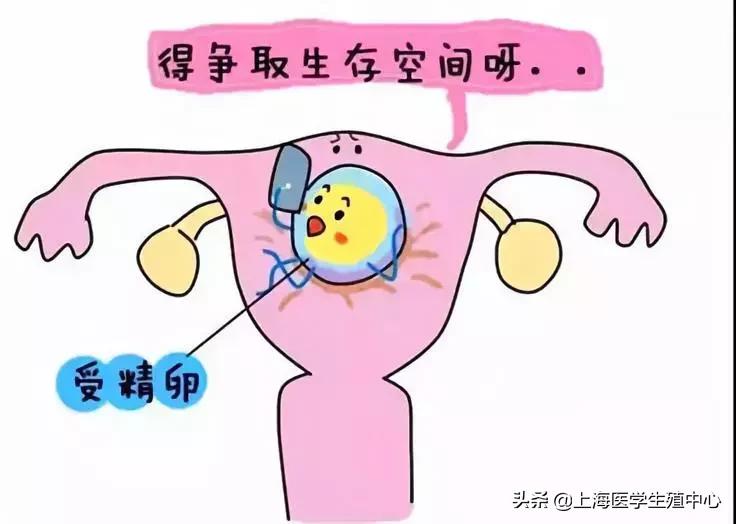 宫腔粘连怎么办才可以怀孕,宫腔粘连怀孕肚子痛