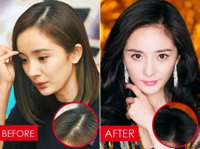 拯救发际线告别大额头,拯救发际线不走冤枉路