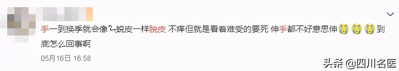 你的手为什么老脱皮,你的手为什么这么糙