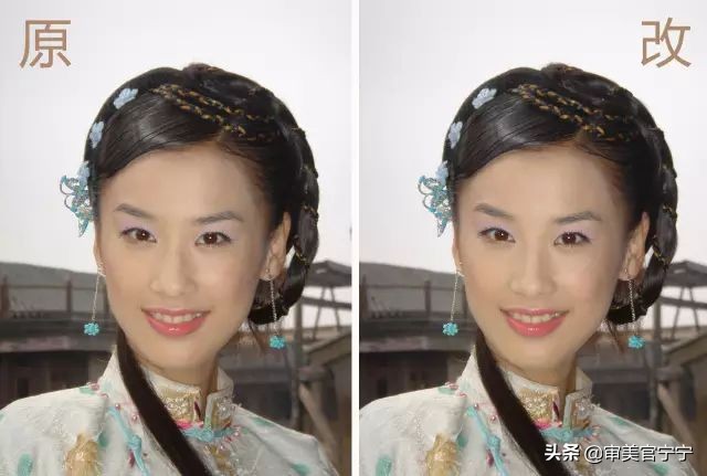 鼻子宽大眼距过近,鼻子宽度大于眼间距原因