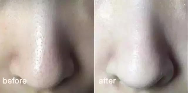 手工皂高颜值蚕丝,蚕丝手工皂祛痘痘