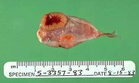 旅游回来胃不舒服,旅游后肚子疼拉肚子