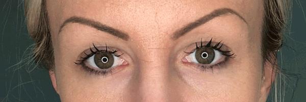 长期开车眼睛疲劳有什么好办法,长期开车有助于恢复视力