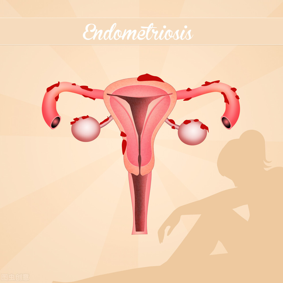 夏天到了不能穿什么,夏天不喜欢穿裙子可以穿什么