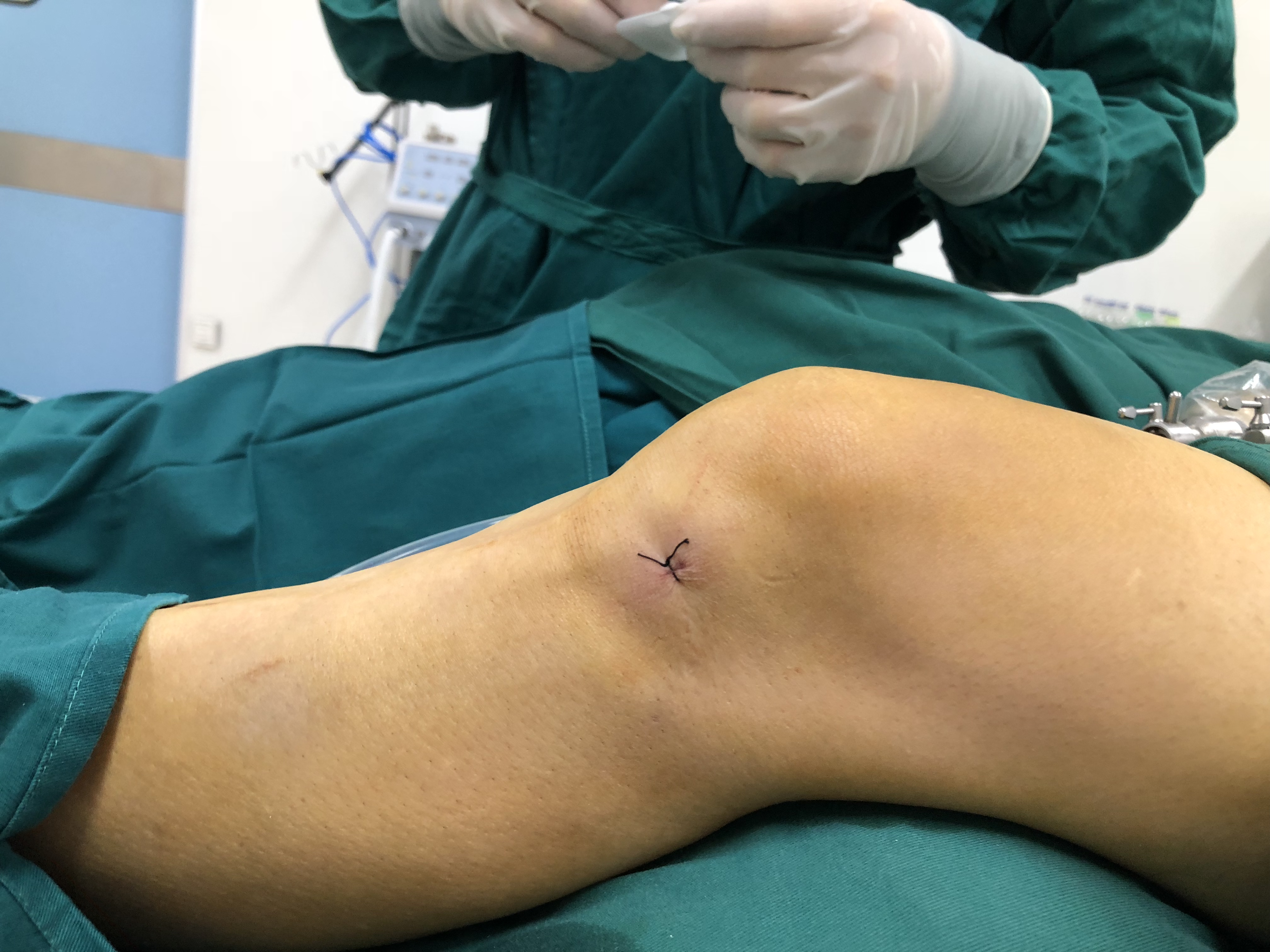 中老年人怎么预防骨性关节炎,老年人得了骨性关节炎要如何治疗