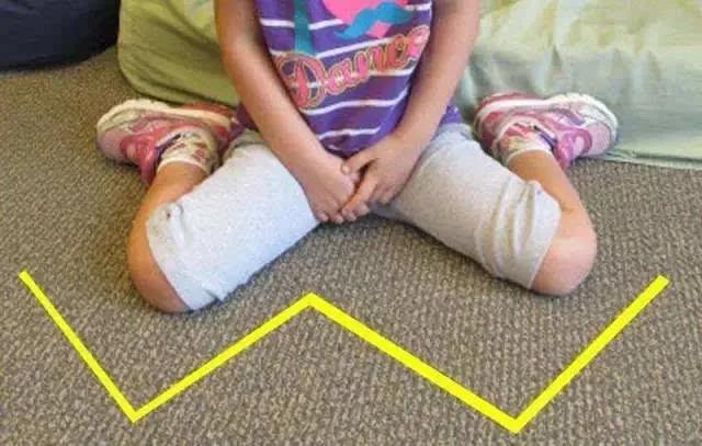 健康训练100个小动作,儿童健康腿怎么练