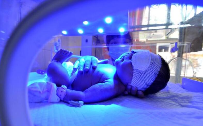 新生儿黄疸严重应该要注意些什么,新生儿黄疸如何去得快一招搞定