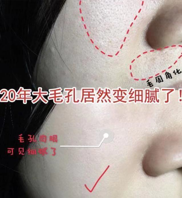 美容黑幕,美容仪内幕大揭秘