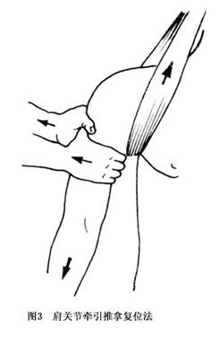 摔倒的肩膀脱位最佳治疗方法,摔了一跤肩袖损伤怎么办