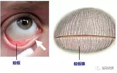 干眼症福音！眼视光眼科干眼治疗新技术