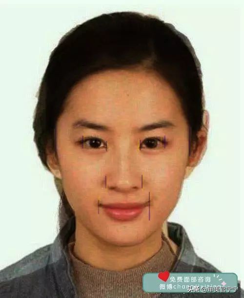 鼻子宽大眼距过近,鼻子宽度大于眼间距原因