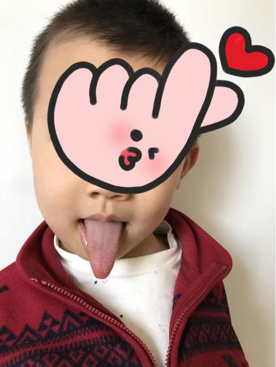 手脚心热的宝宝怎么调理,小孩手脚心潮湿凉