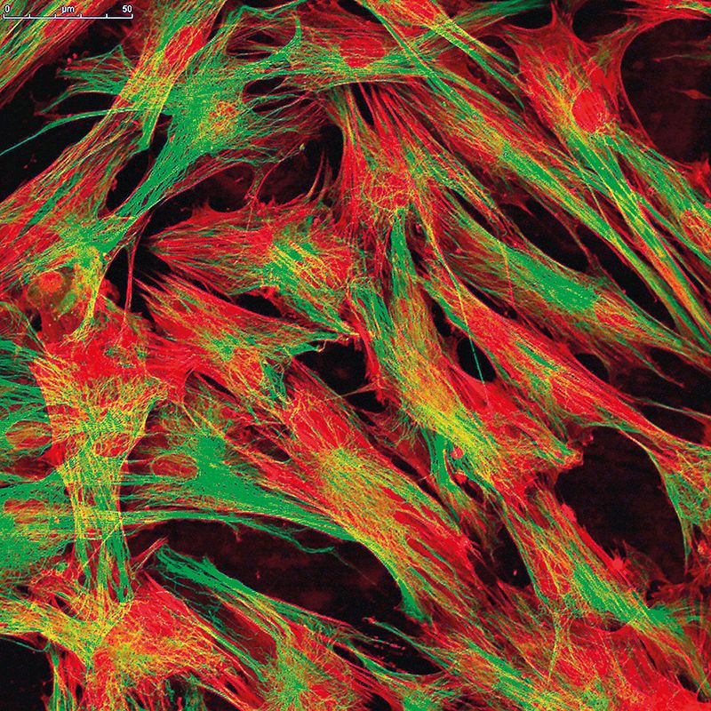 皮肤疤痕难以愈合原因,皮肤愈合用什么不留疤