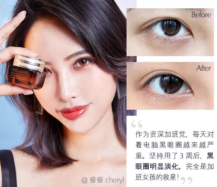 25岁以后每天都要用眼霜吗,25岁之后一定要用的眼霜