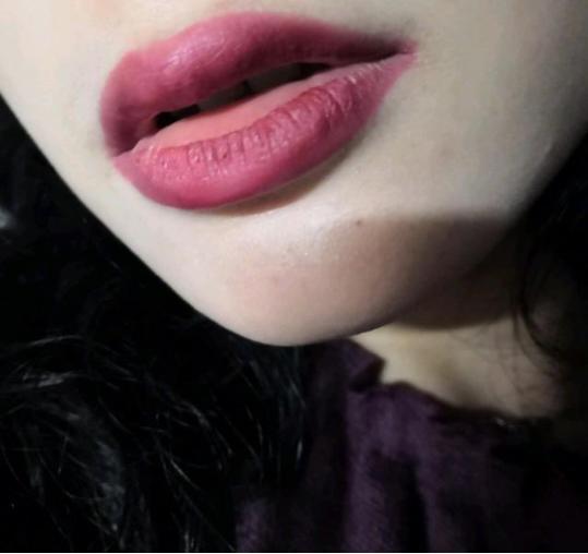 笑起来比较丑的唇形,唇形丑怎么改善