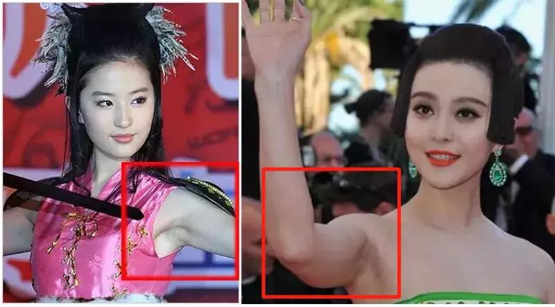 现在美容最火项目,激光脱毛品牌推荐美容院