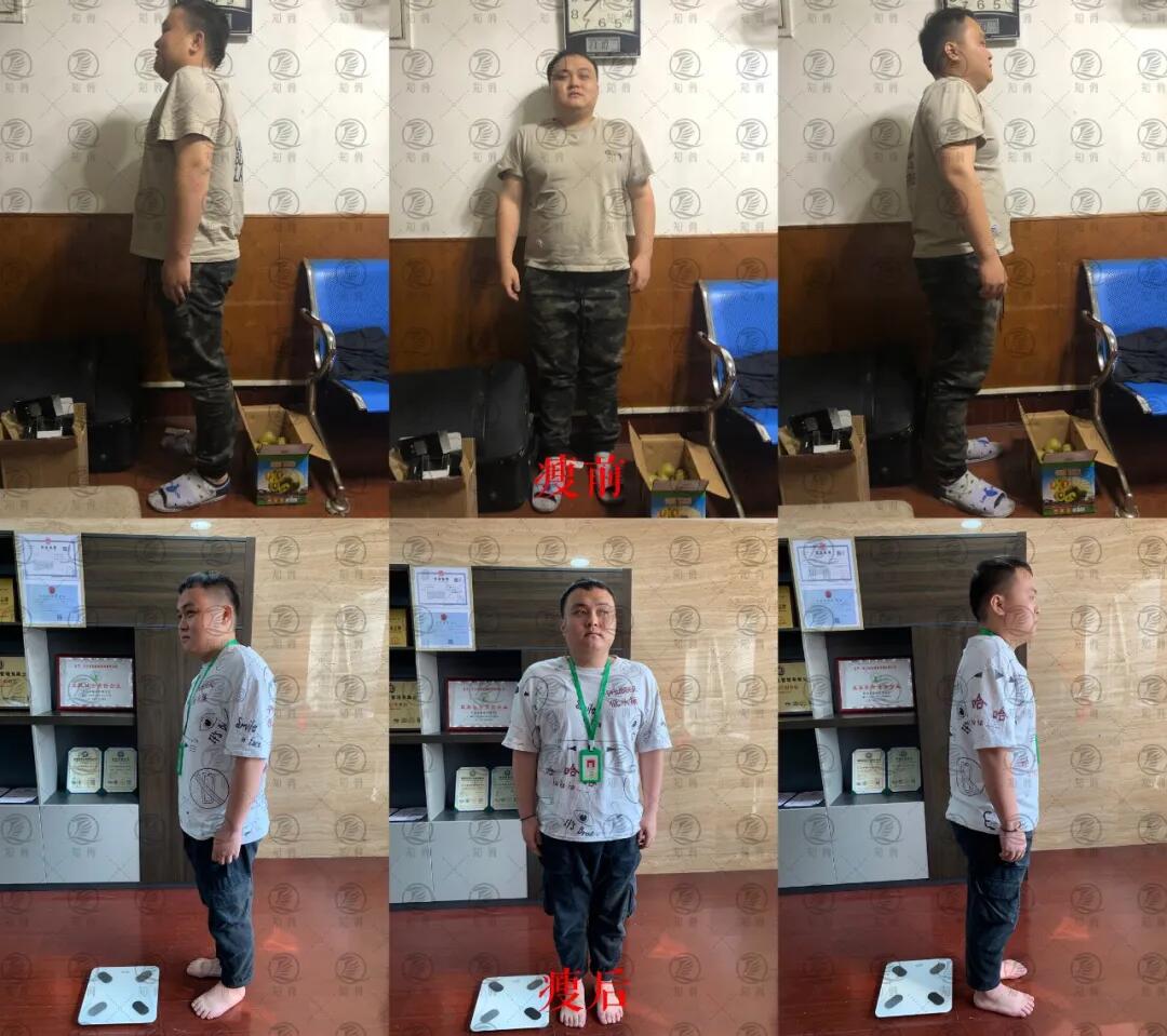 【知俏案例】减脂大作战！看减肥大赛冠军如何月瘦20斤？