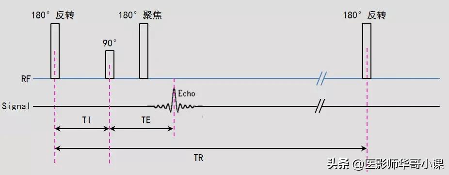 磁共振mri序列参数解读,磁共振mrcp用哪些序列
